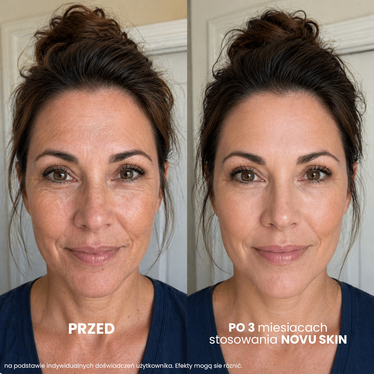 NOVU SKIN Mesoinfuse -zestaw przeciwzmarszczkowo - nawilżający