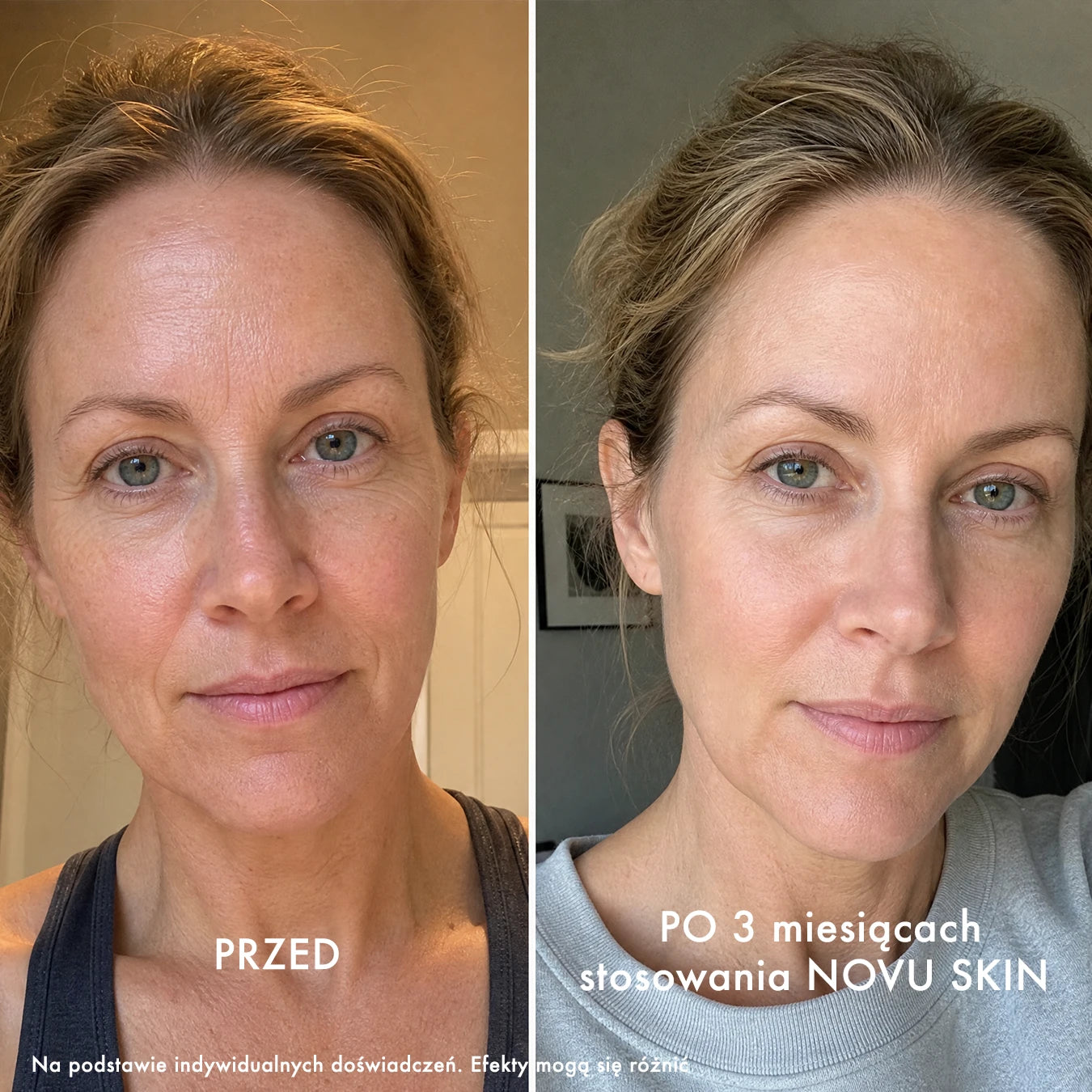 NOVU SKIN Mesoinfuse - zestaw rozświetlająco - regenerujący z peptydami