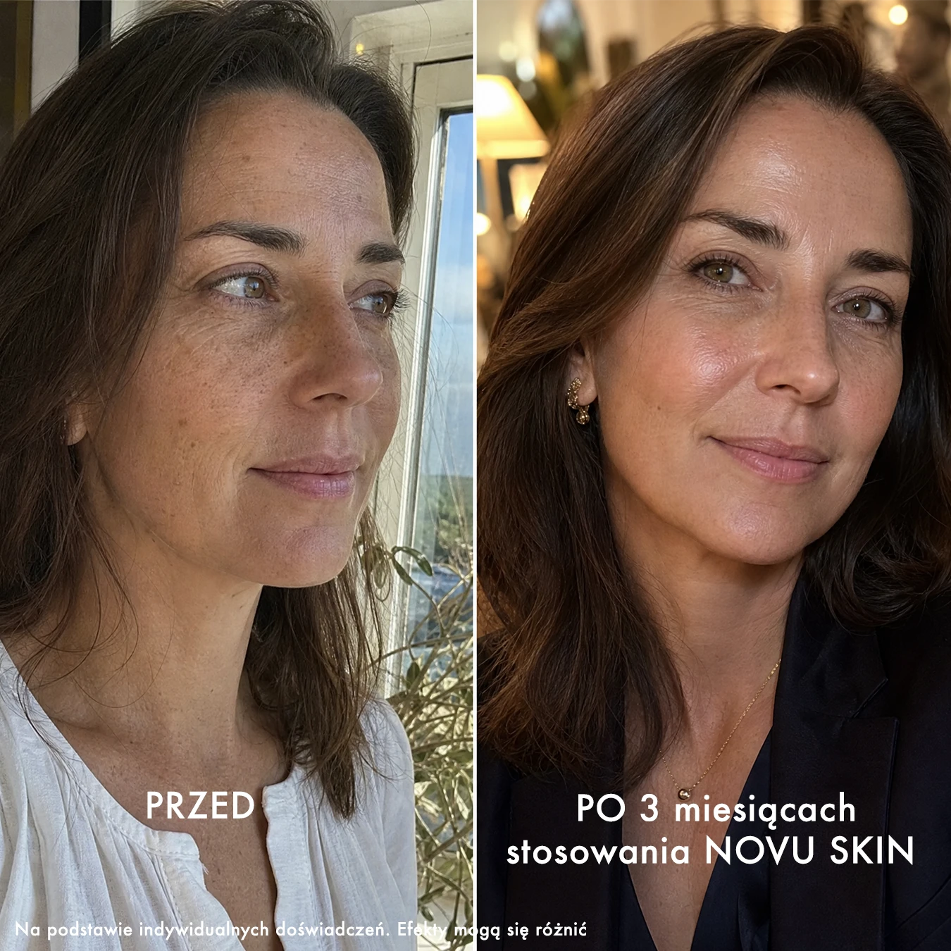 NOVU SKIN Mesoinfuse - zestaw rozświetlająco - regenerujący z peptydami