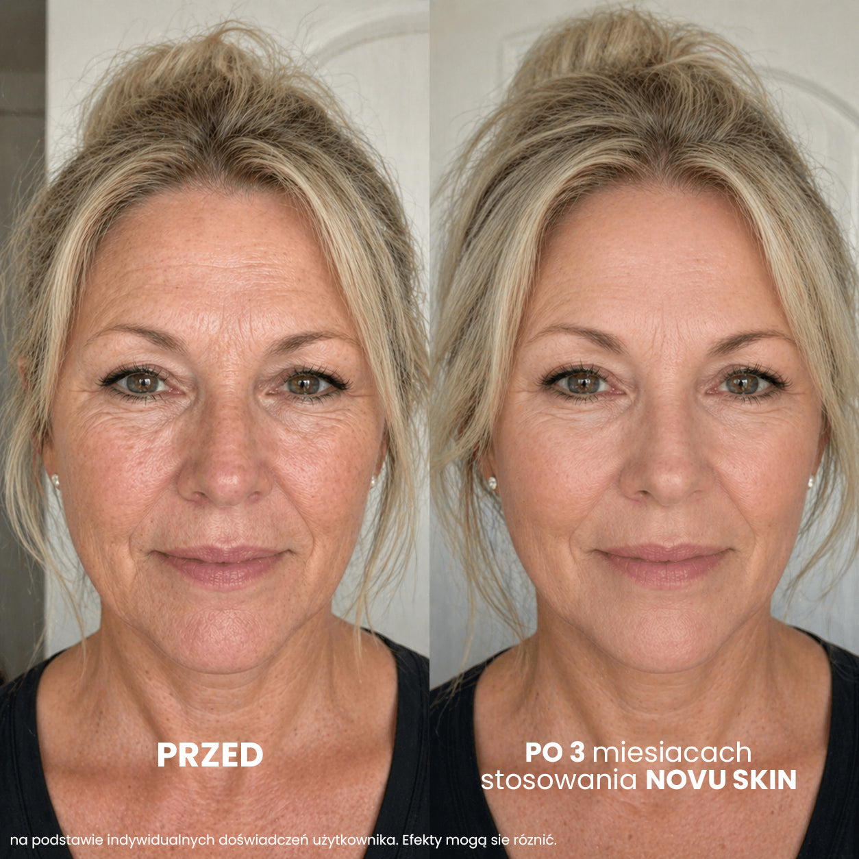 NOVU SKIN Mesoinfuse -zestaw przeciwzmarszczkowo - nawilżający